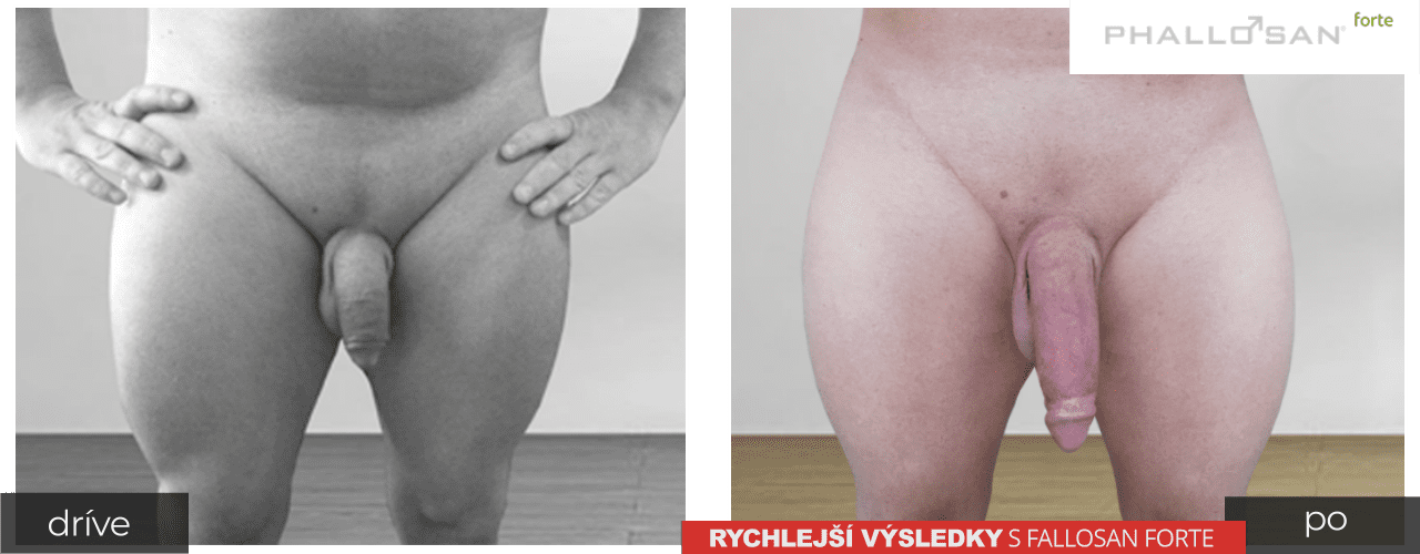 Zvětšete penis s Phallosan forte