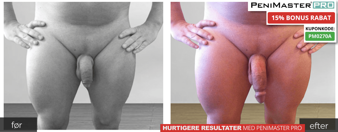 PeniMaster Pro før og efter billeder