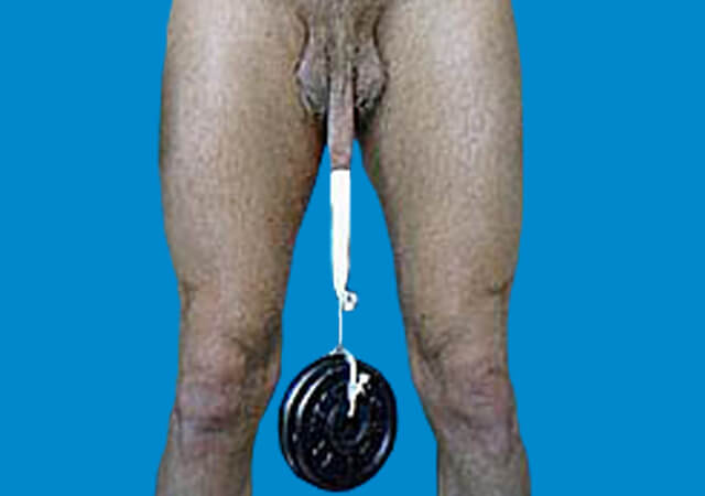 Penile stretching with weights