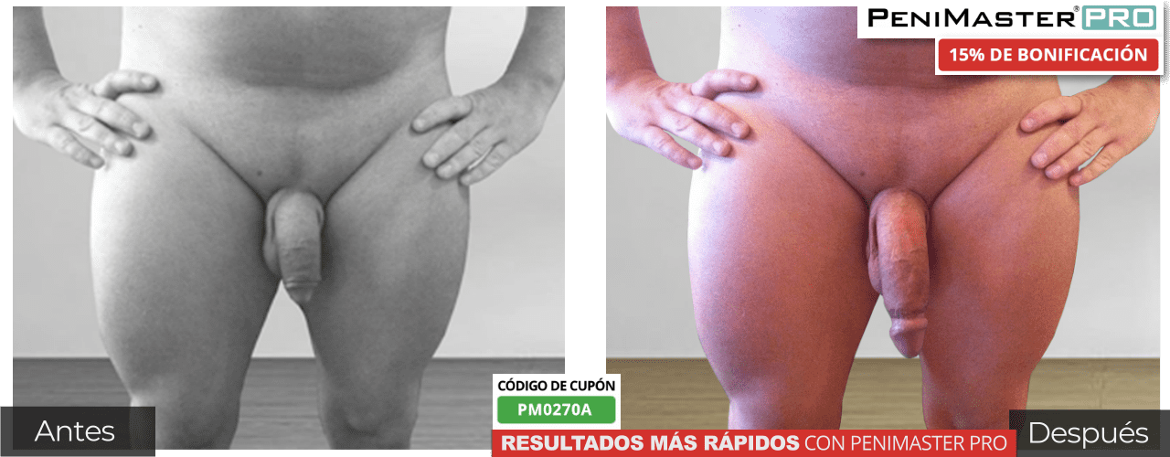 El extensor de pene PeniMaster Pro