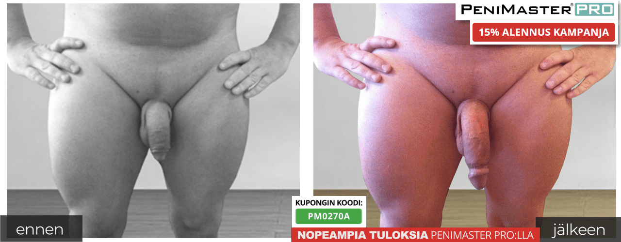 Valmistajalle ennen ja jälkeen tuloksia ja kuvia
