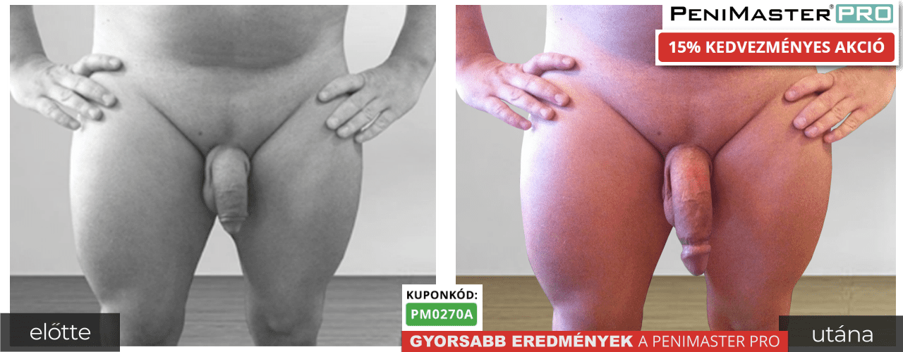 PeniMaster Pro előtt utána eredmények és képek