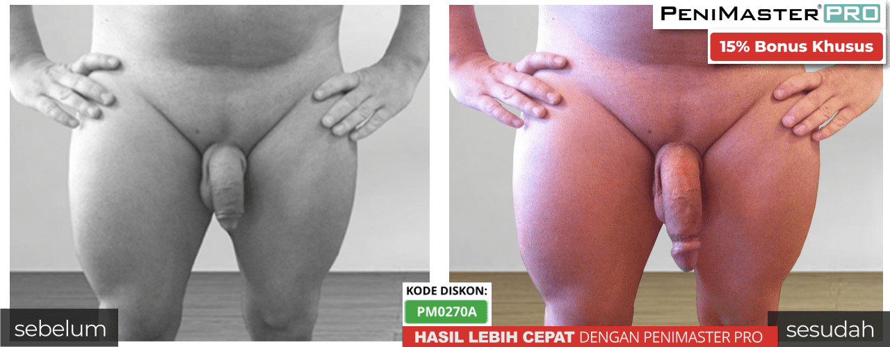 PeniMaster Pro sebelum dan sesudah gambar