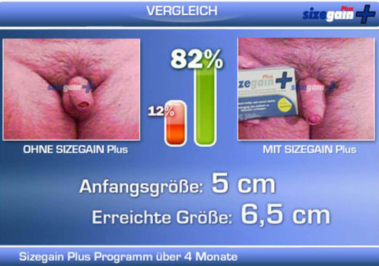 4 Monate SizeGain Plus Ergebnisse