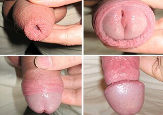 Jelqing instruktion för penis med förhud