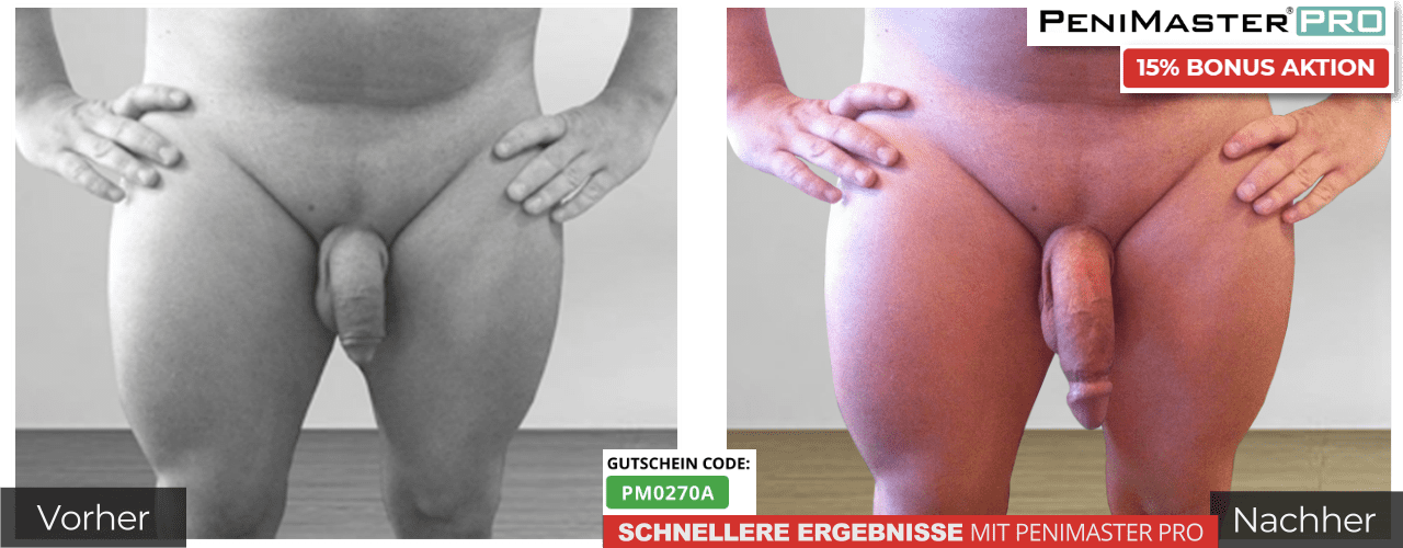 PeniMaster Pro vorher nachher Bilder
