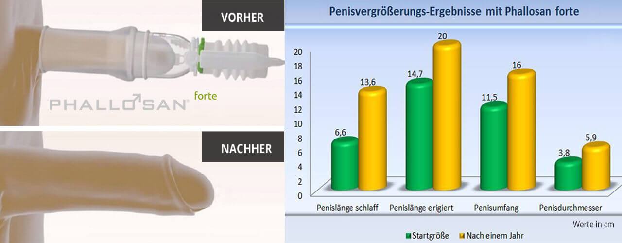 Peyronie Therapie funktioniert