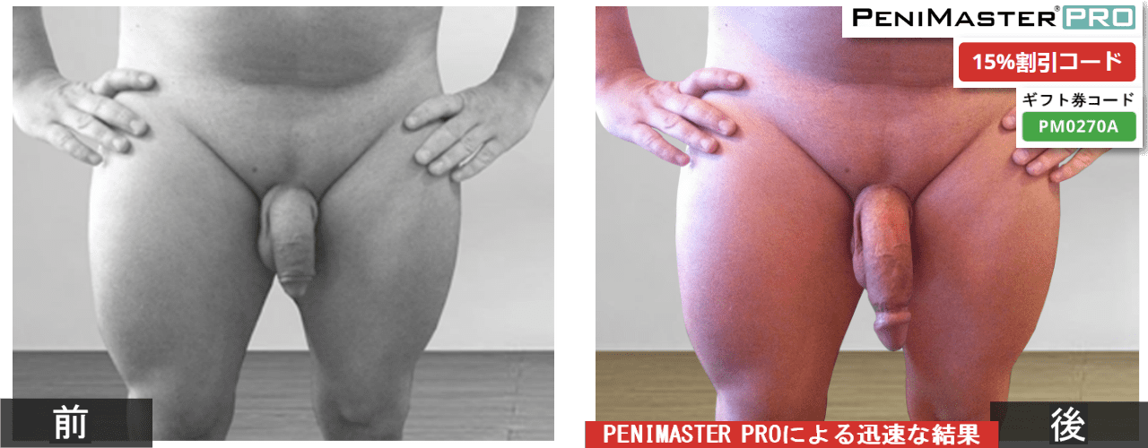 PeniMaster Proビフォー・アフター写真
