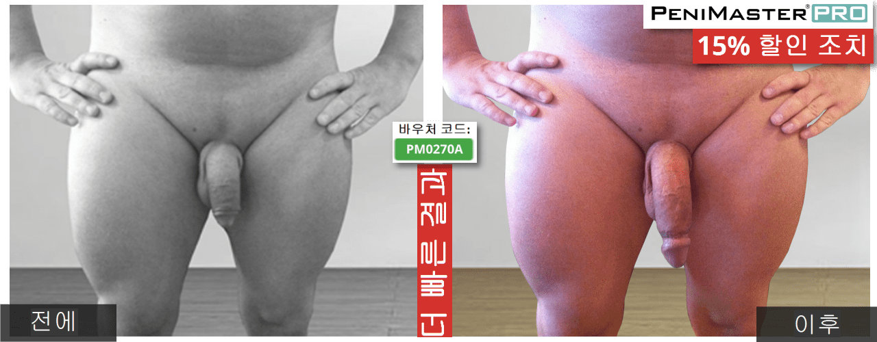 PeniMaster Pro 전후 사진