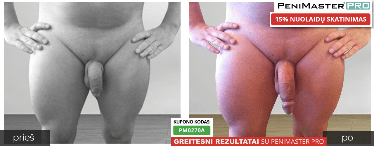 PeniMaster Pro prieš ir po rezultatų ir nuotraukų