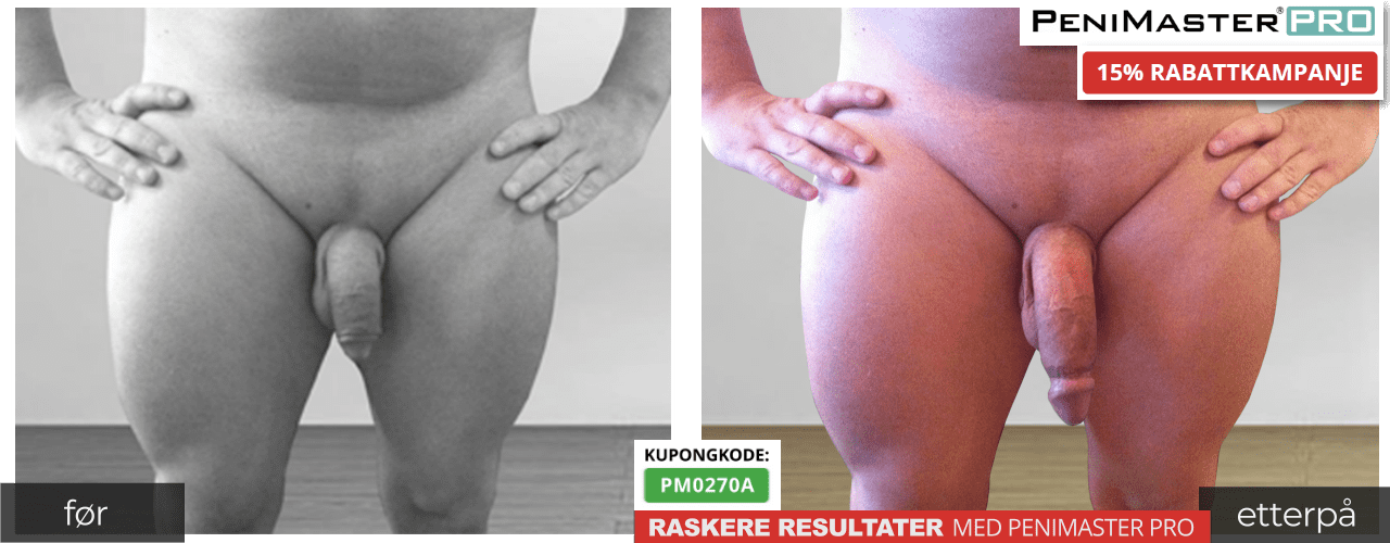 PeniMaster Pro før og etter resultater med bilder