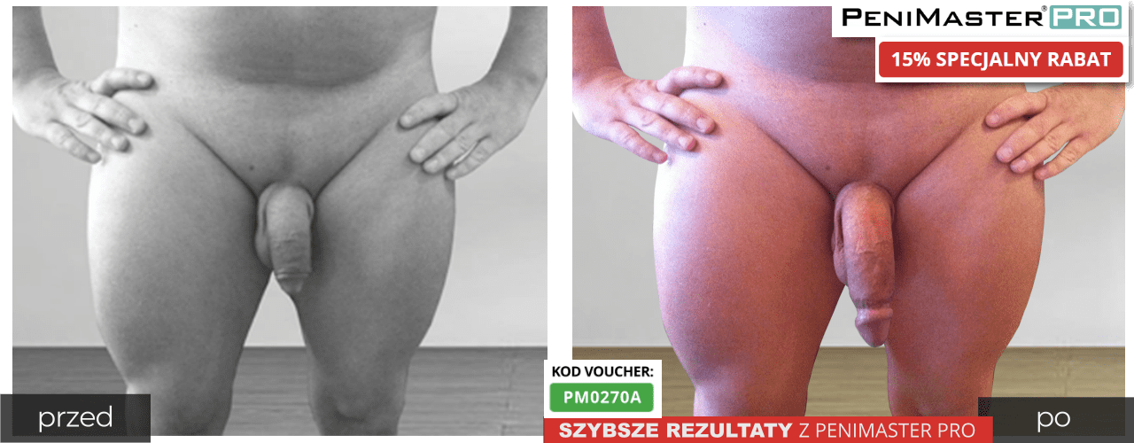 Wyniki PeniMaster Pro przed i po