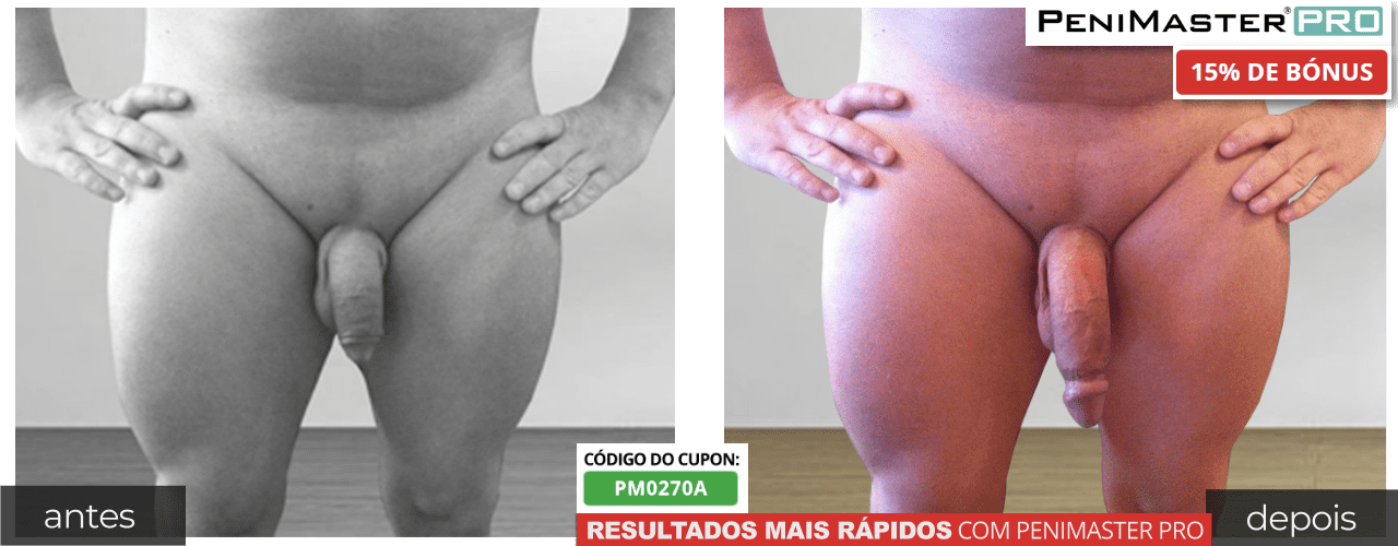 Extensor pêniano PeniMaster Pro antes depois