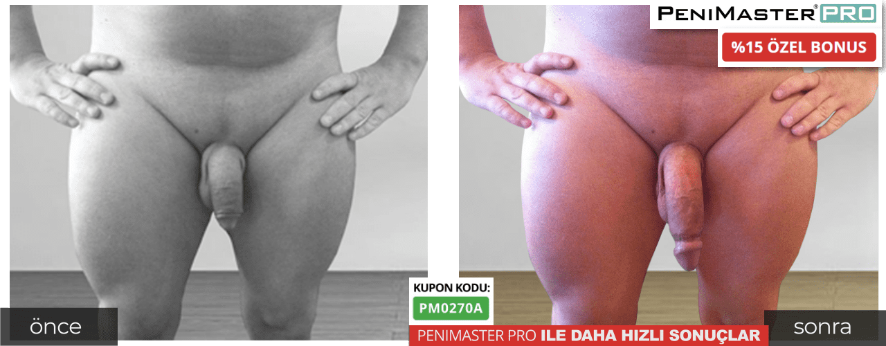 PeniMaster Pro resimleri önce sonra